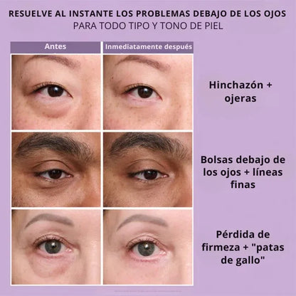 Daynava™ Lifting de Ojos Instantáneo