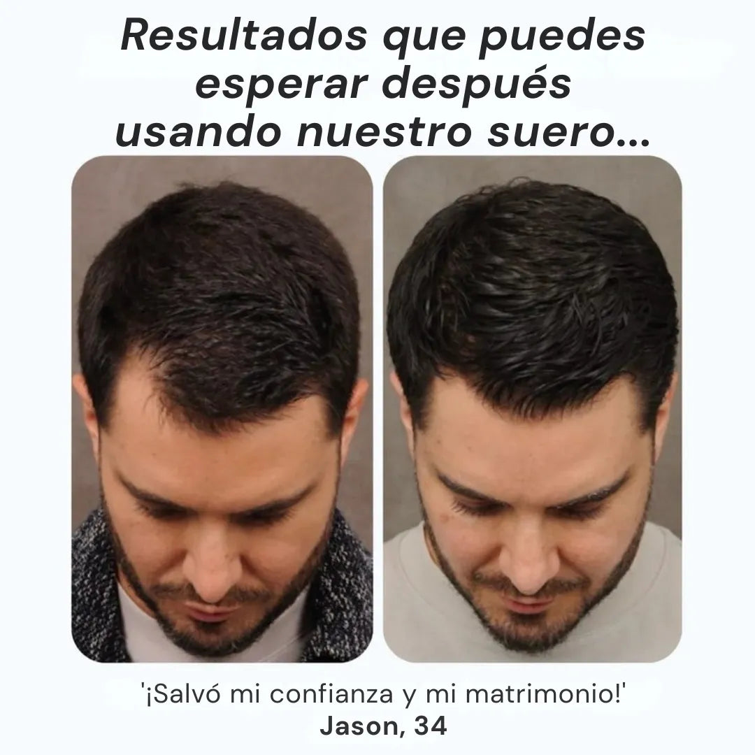 Daynava™ Roll-On para el Crecimiento del Cabello