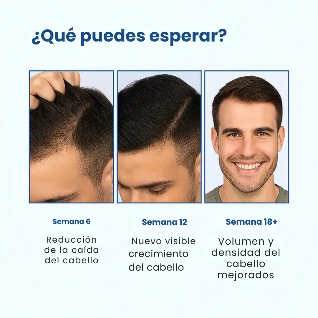 Daynava™ Roll-On para el Crecimiento del Cabello