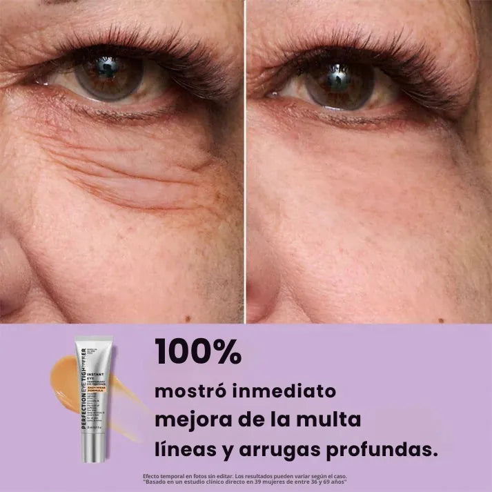 Daynava™ Lifting de Ojos Instantáneo