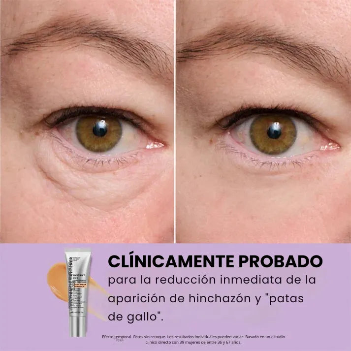 Daynava™ Lifting de Ojos Instantáneo